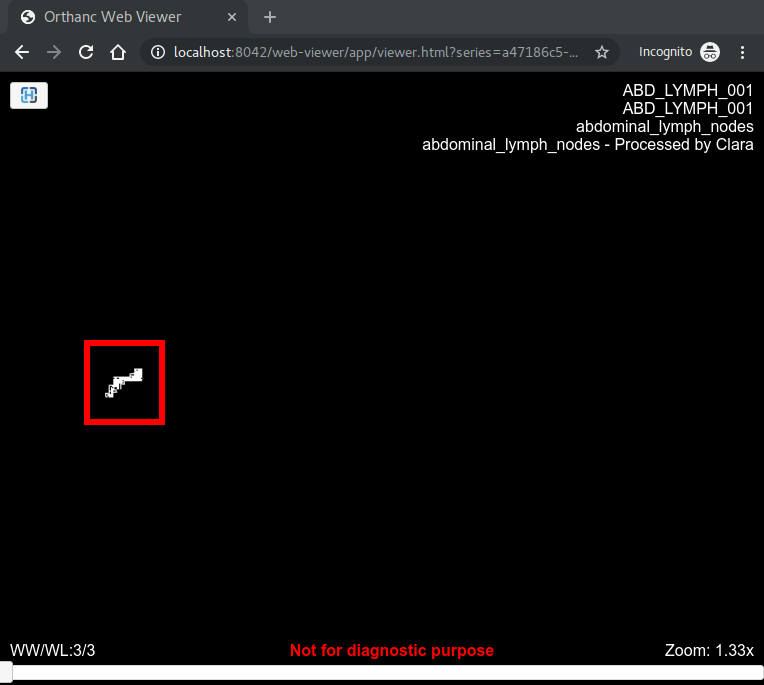 Segmentation.png